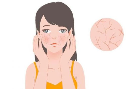 ：修护敏感肌肤重塑健康屏障OG真人第二代薇诺娜特护霜(图3)